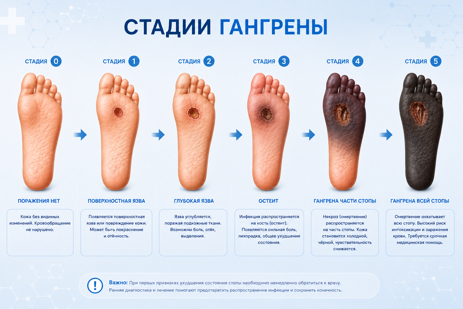 Как проявляет себя гангрена