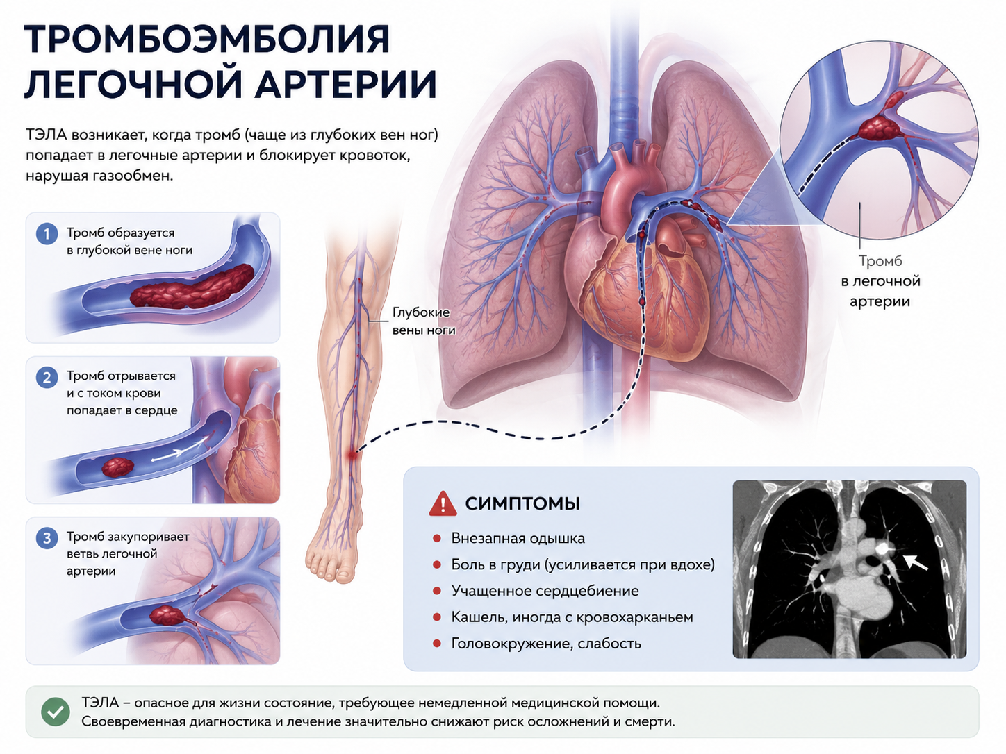Диагностика тромбоэмболии в клинике