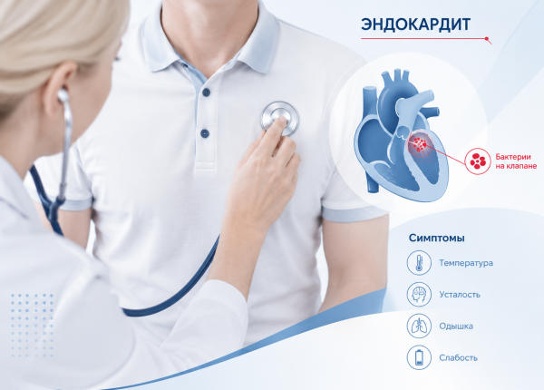 Причины, виды и формы эндокардита