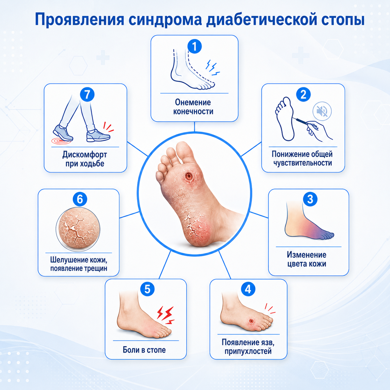 Лечение диабетической стопы